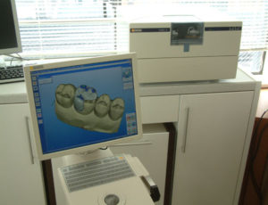 コンピュータによる歯の設計 / wikipedia より