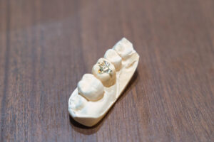 ゴールドの詰めもの