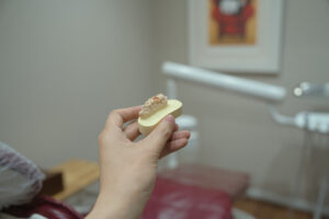 歯科模型を持つ手